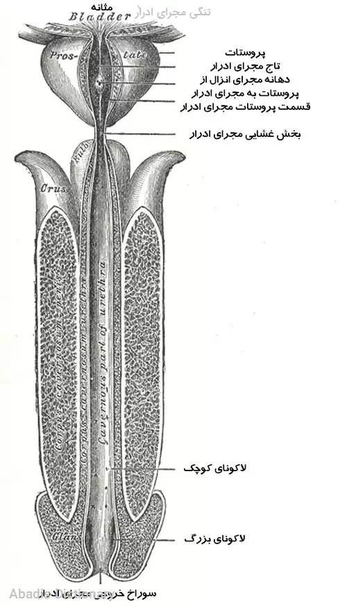 تنگی مجرای ادرار